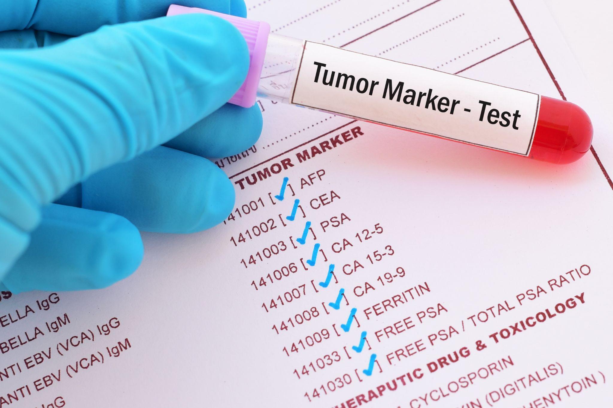 Decoding Tumour Markers: Unveiling Insights Into Cancer Detection and ...