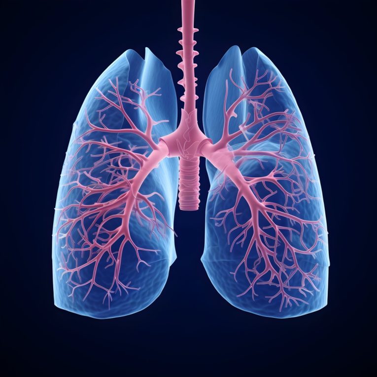 lung cancer