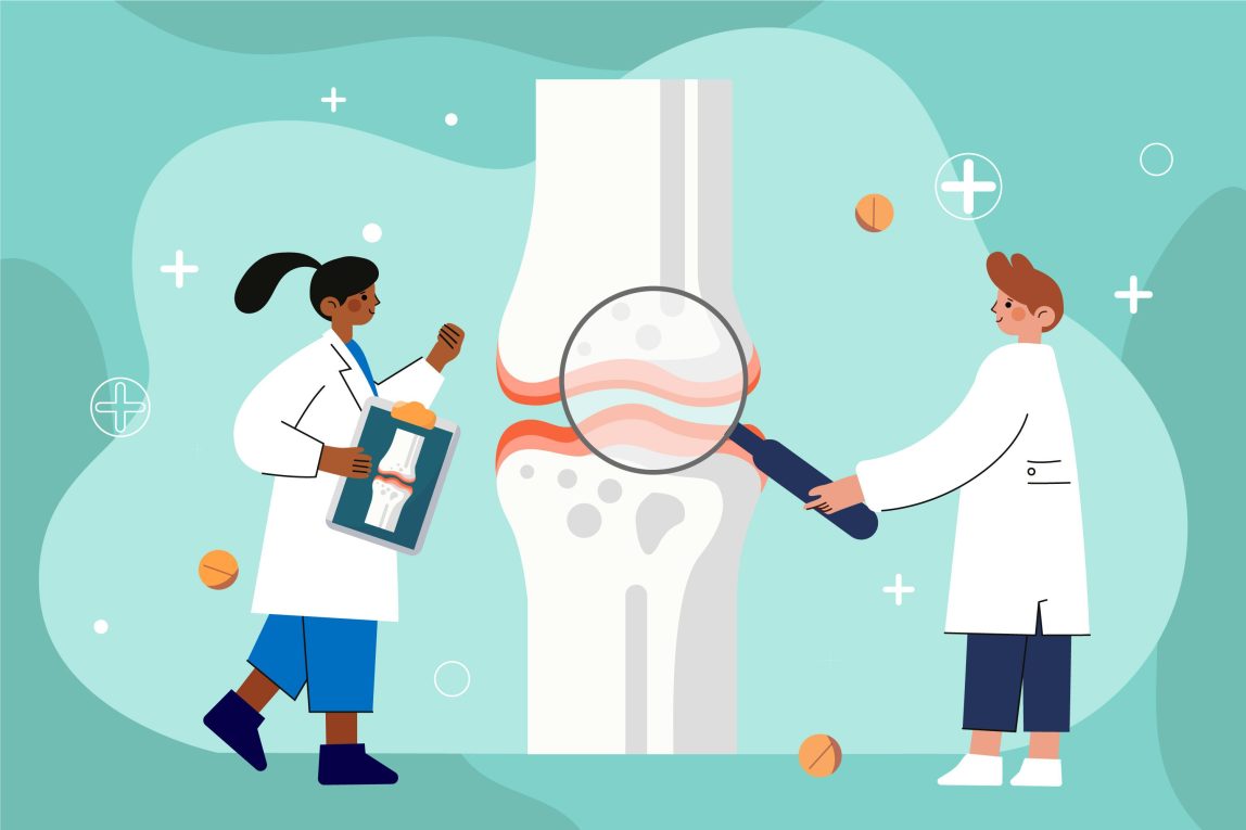 Knee Replacement Surgery: Exploring the Benefits, Risks, and What to Expect