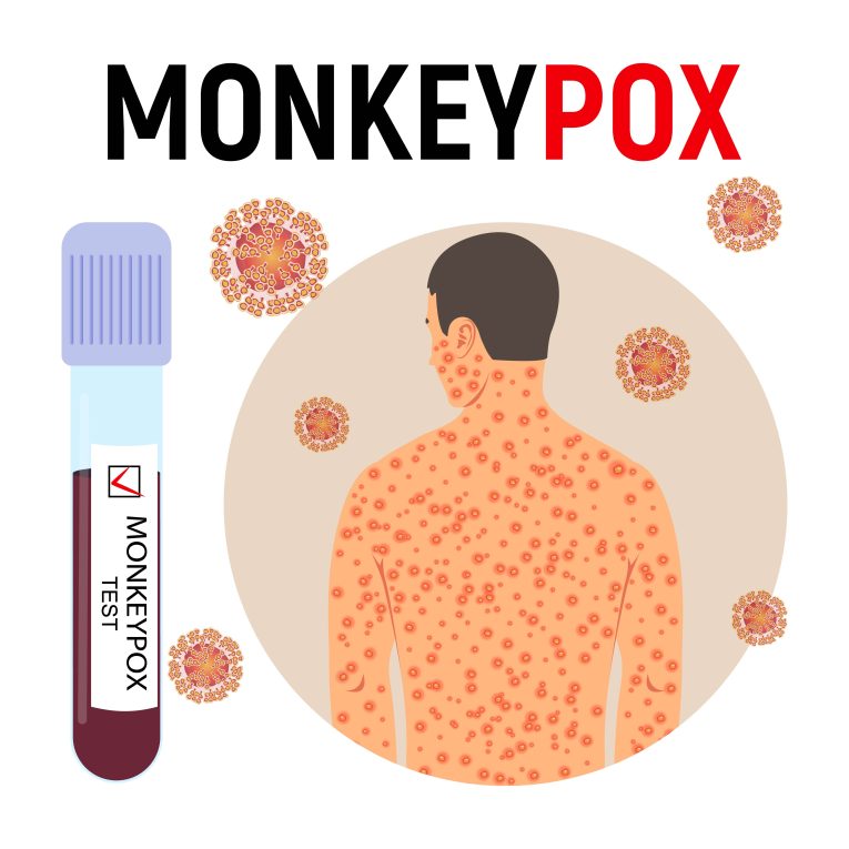 monkey pox