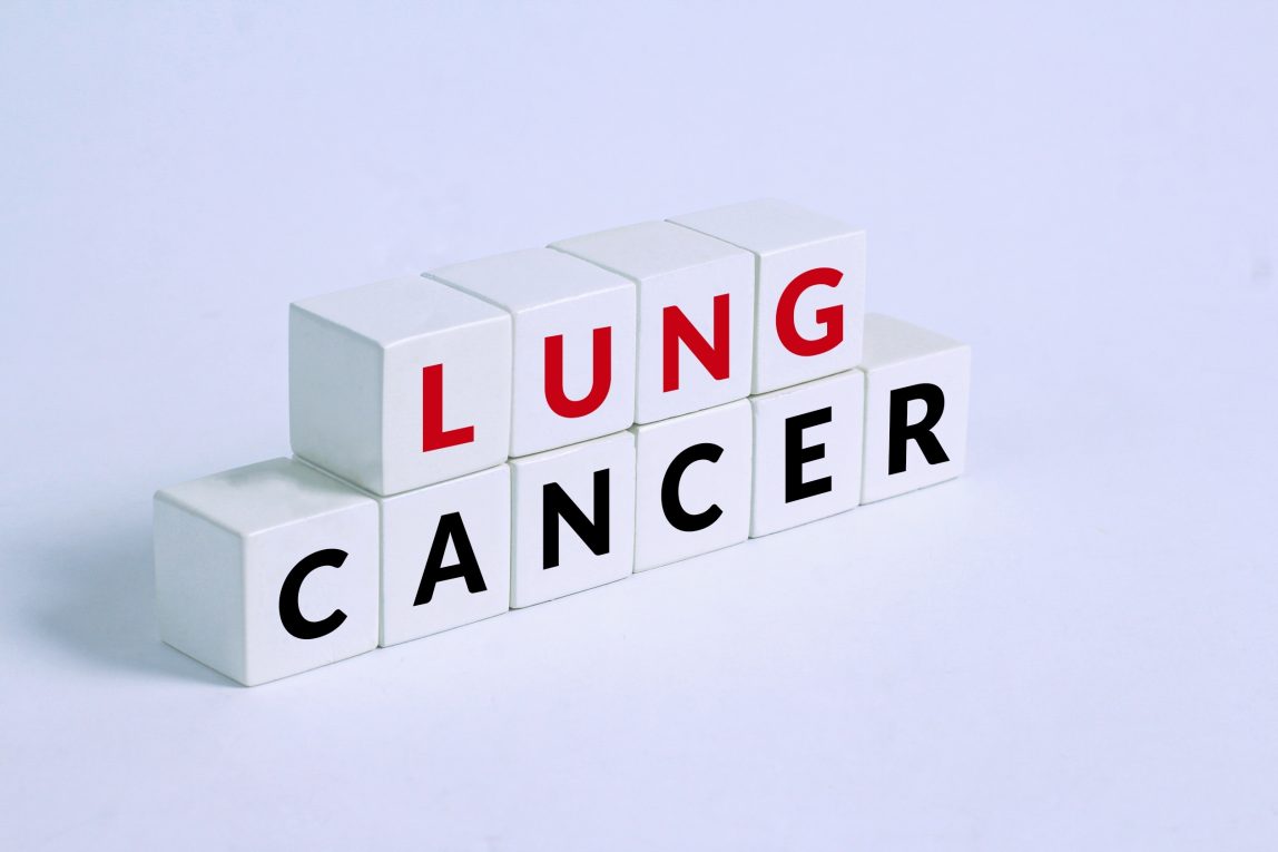 9 Lung Cancer Risk Factors Uncovered: Vital Knowledge for Early Detection and Prevention