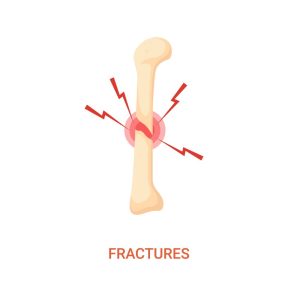 Bone fracture