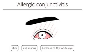 Eye allergens