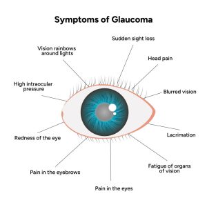 Symptoms of Glaucoma