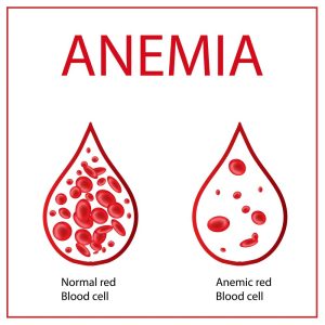 Anaemia 