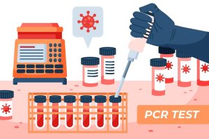 polymerase chain reaction (PCR) tests