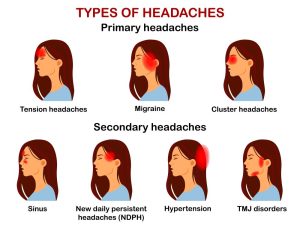 Headaches