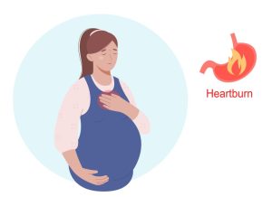 Heartburn in pregnancy