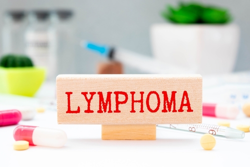 2. Identifying Different Types of Lymphoma