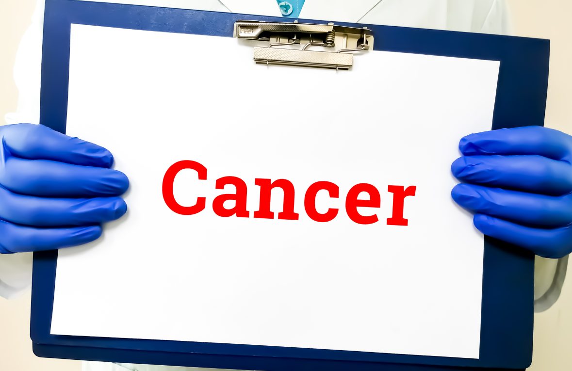 What Are the Risk Factors for Secondary Cancers?